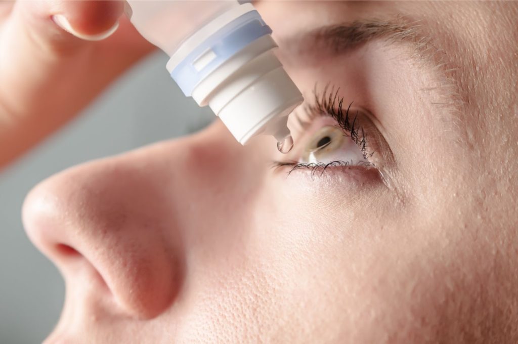 An up-close on a woman using artificial tears to relieve her dry eye
